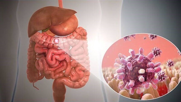Wellhealthorganic.com : Key Signs of Gastroenteritis